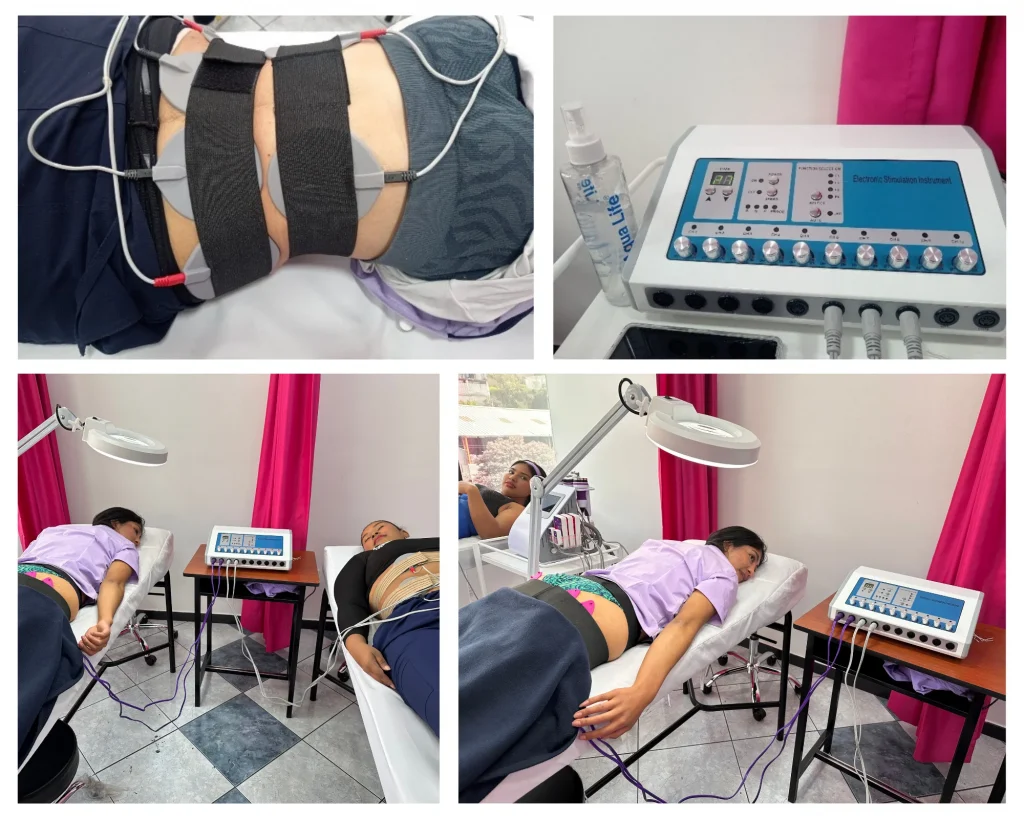 Electroestimulación dirigida a objetivos estéticos