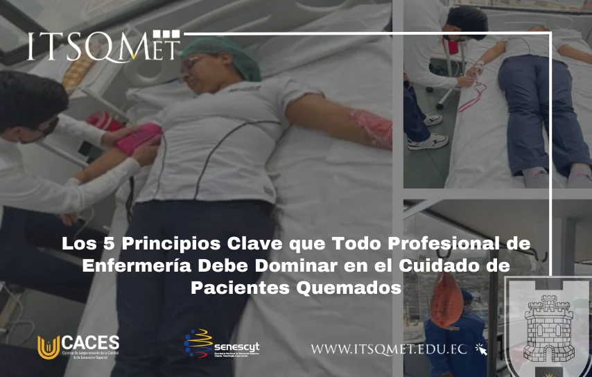 Fundamentos Esenciales en el Cuidado de Pacientes con Quemaduras